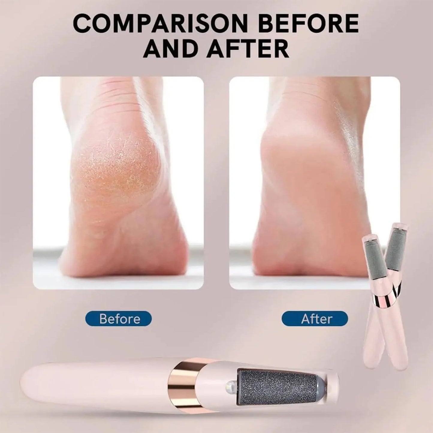 Professional Pedicure Electronic Callus Remover and Foot Care Tool