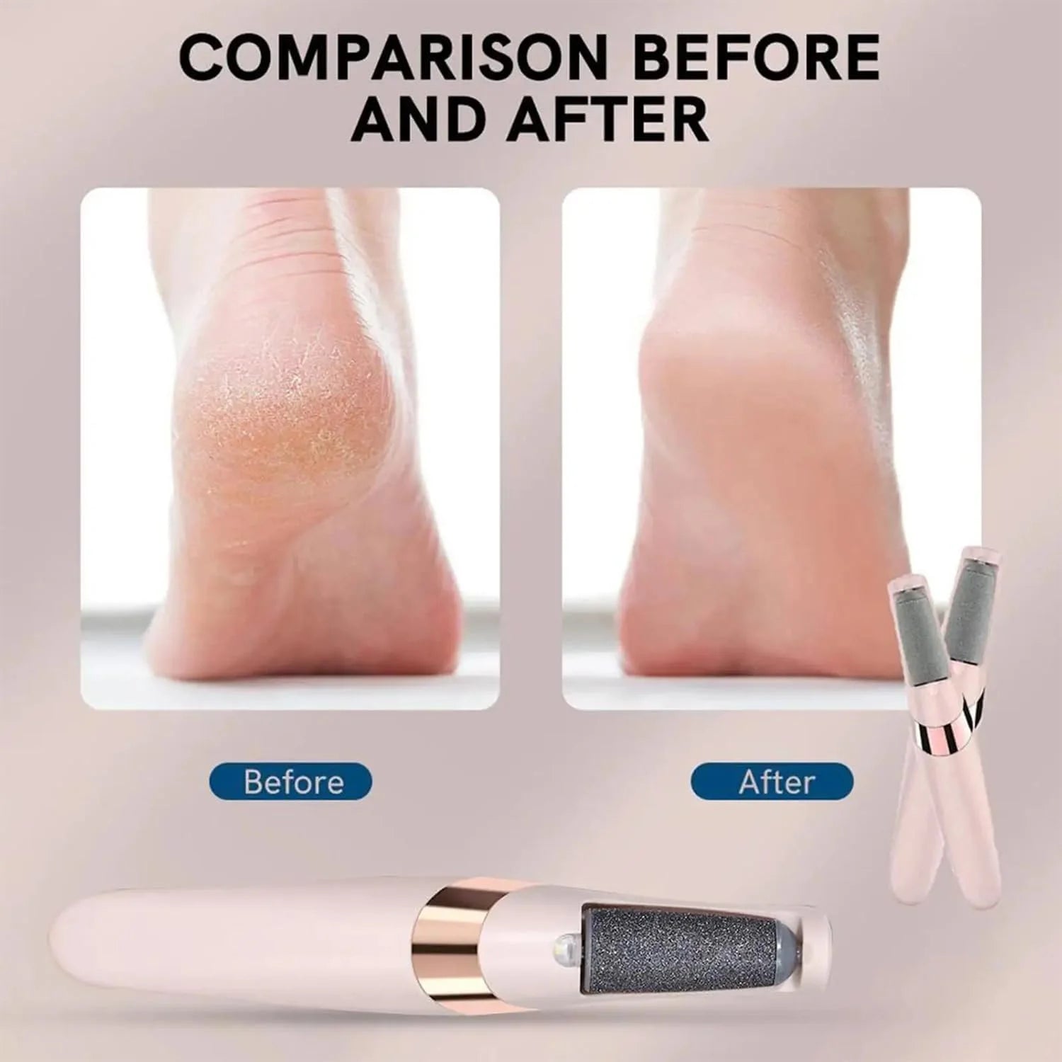 Professional Pedicure Electronic Callus Remover and Foot Care Tool