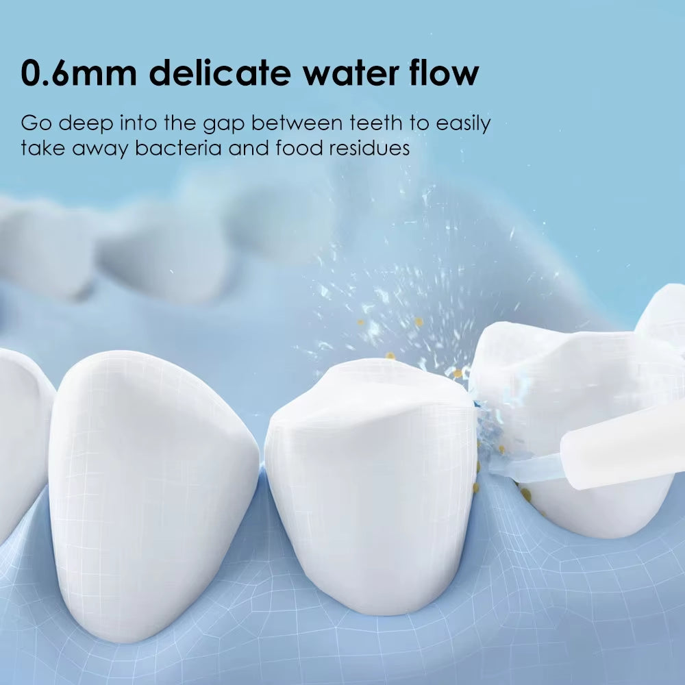 Youpin Portable Electric Oral Irrigator with Detachable Water Flosser, Waterproof Dental Water Jet, Includes 4 Nozzles